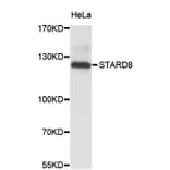 Western Blot - Anti-STARD8 Antibody (A4336) - Antibodies.com
