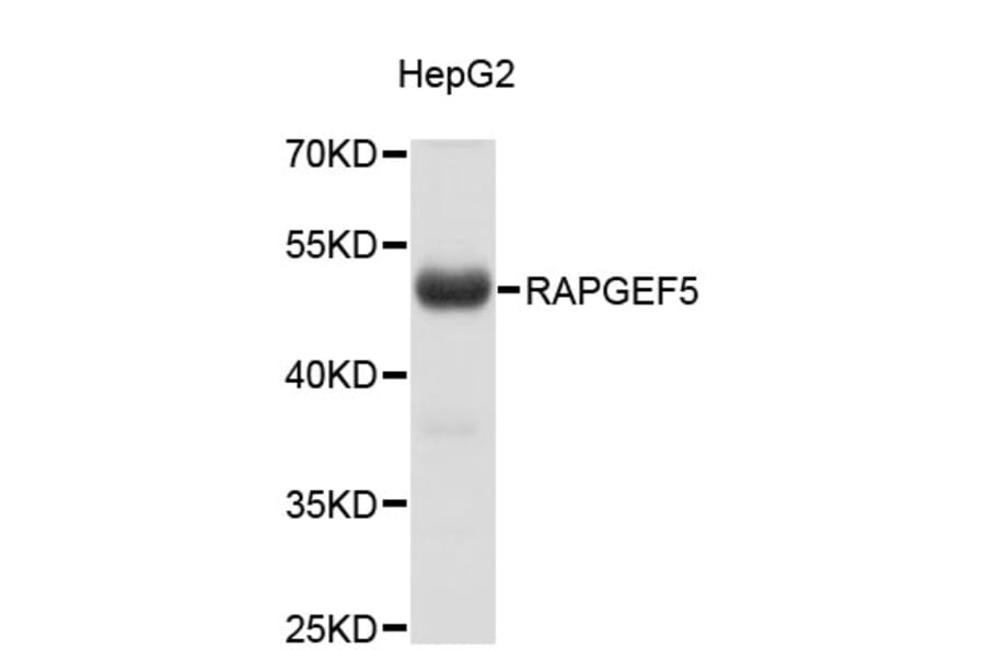 Western Blot - Anti-RAPGEF5 Antibody (A4337) - Antibodies.com