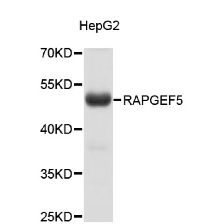 Western Blot - Anti-RAPGEF5 Antibody (A4337) - Antibodies.com