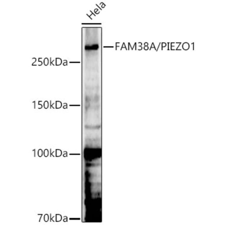 Western Blot - Anti-FAM38A/PIEZO1 Antibody (A9443) - Antibodies.com