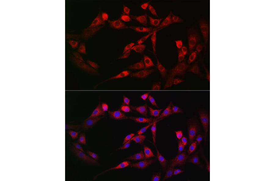 Immunofluorescence - Anti-FAM38A/PIEZO1 Antibody (A9443) - Antibodies.com
