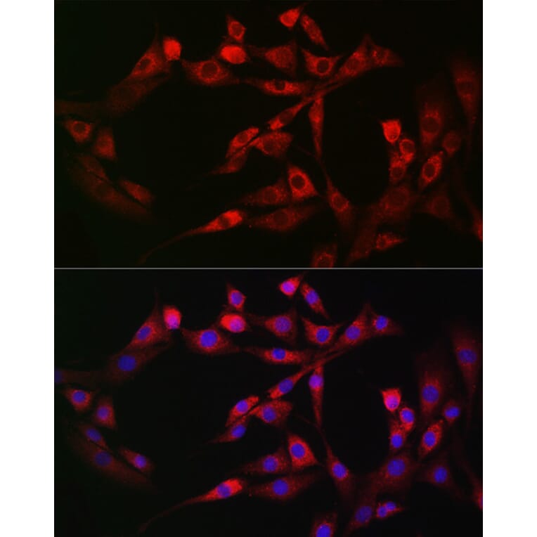 Immunofluorescence - Anti-FAM38A/PIEZO1 Antibody (A9443) - Antibodies.com