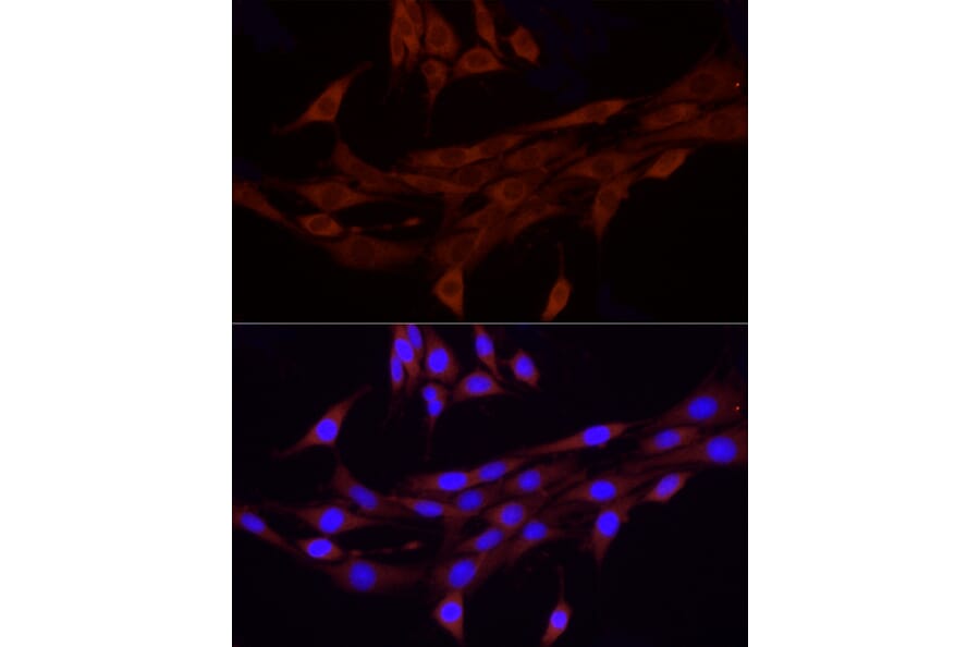 Immunofluorescence - Anti-FAM38A/PIEZO1 Antibody (A9443) - Antibodies.com