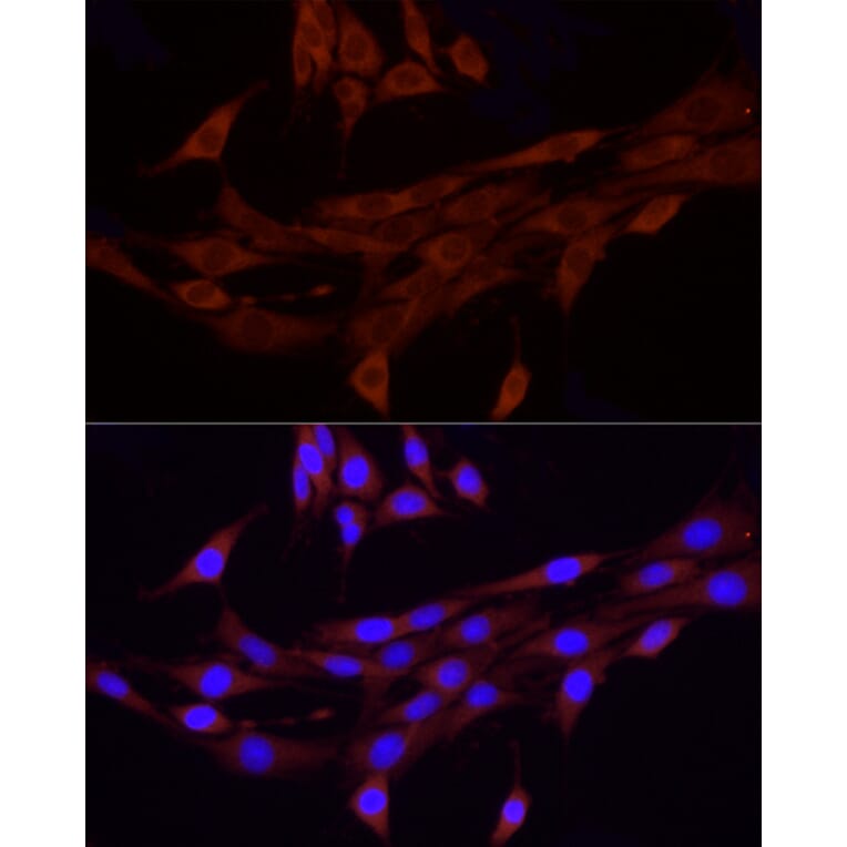 Immunofluorescence - Anti-FAM38A/PIEZO1 Antibody (A9443) - Antibodies.com