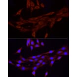 Immunofluorescence - Anti-FAM38A/PIEZO1 Antibody (A9443) - Antibodies.com