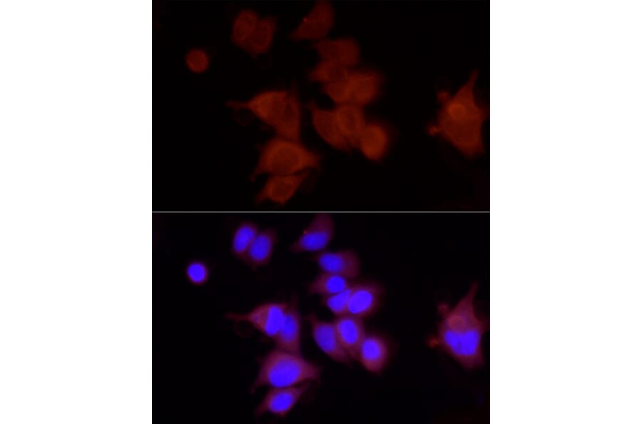 Immunofluorescence - Anti-FAM38A/PIEZO1 Antibody (A9443) - Antibodies.com