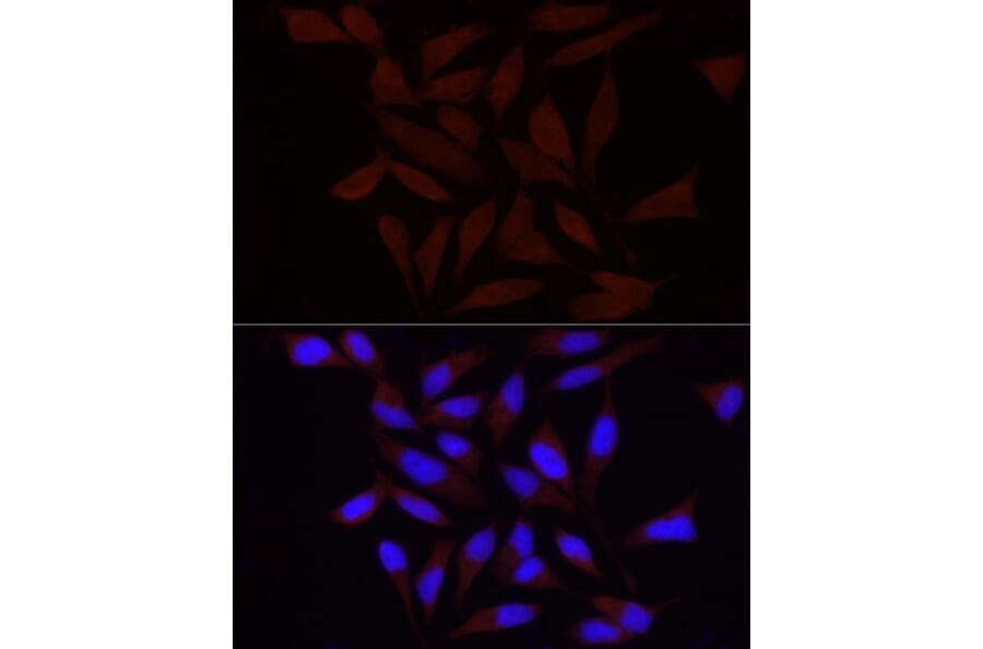 Immunofluorescence - Anti-FAM38A/PIEZO1 Antibody (A9443) - Antibodies.com