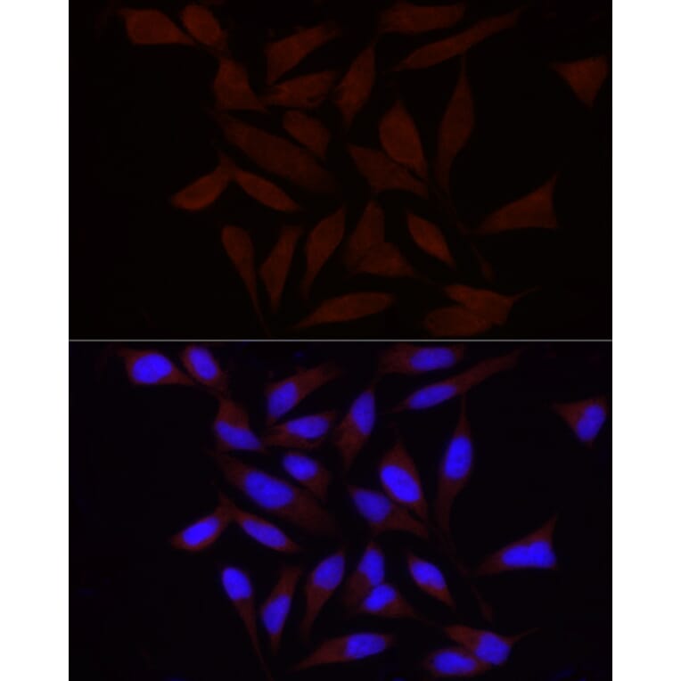 Immunofluorescence - Anti-FAM38A/PIEZO1 Antibody (A9443) - Antibodies.com