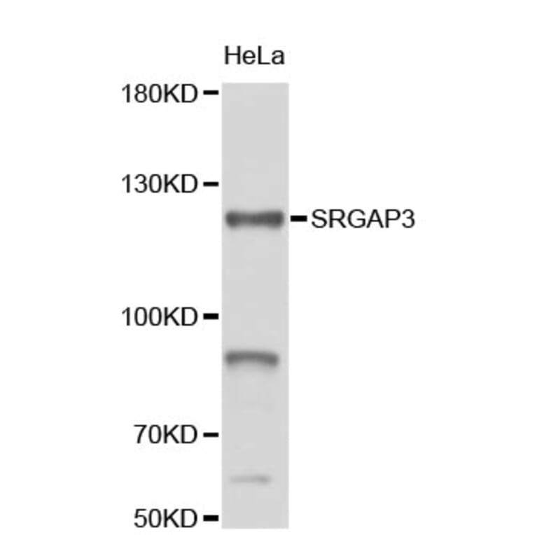 Western Blot - Anti-SRGAP3 Antibody (A4354) - Antibodies.com