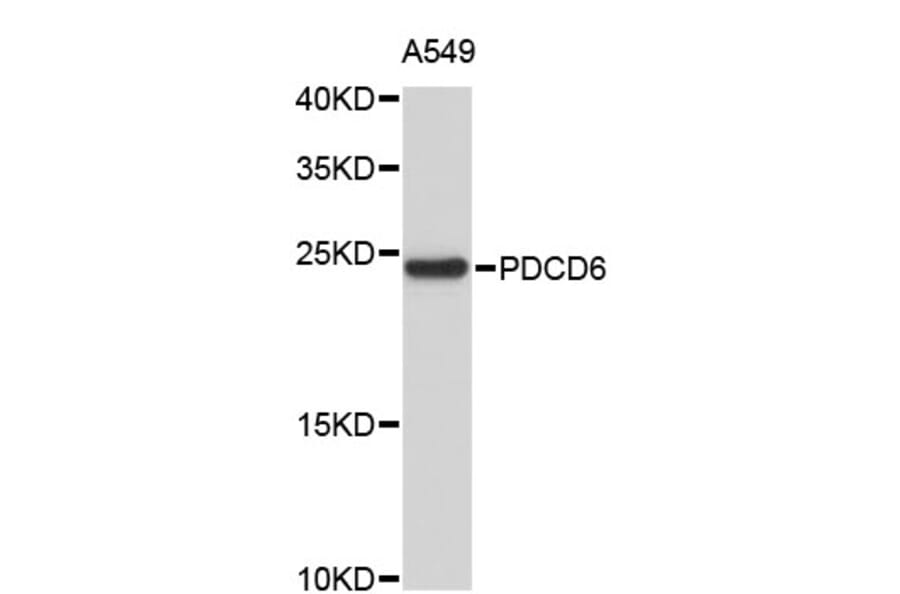 Western Blot - Anti-PDCD6 Antibody (A4359) - Antibodies.com