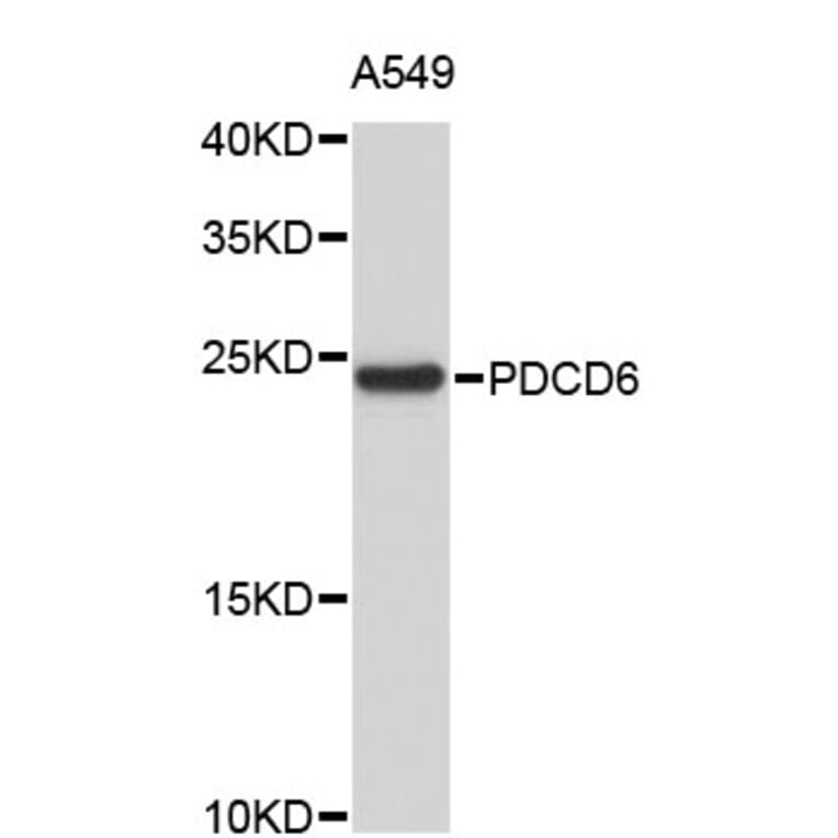 Western Blot - Anti-PDCD6 Antibody (A4359) - Antibodies.com