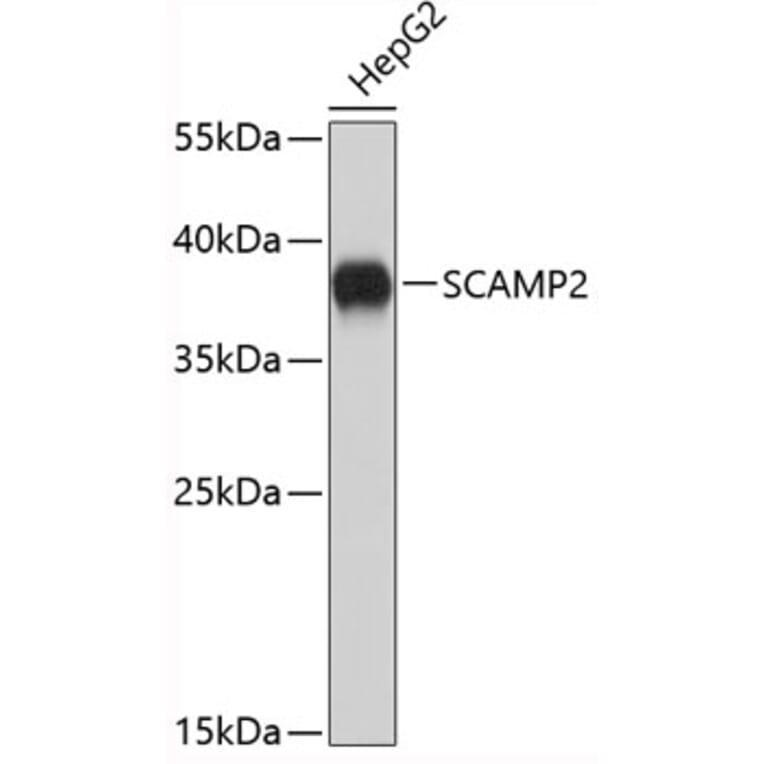 Western Blot - Anti-SCAMP2/SC2 Antibody (A9447) - Antibodies.com