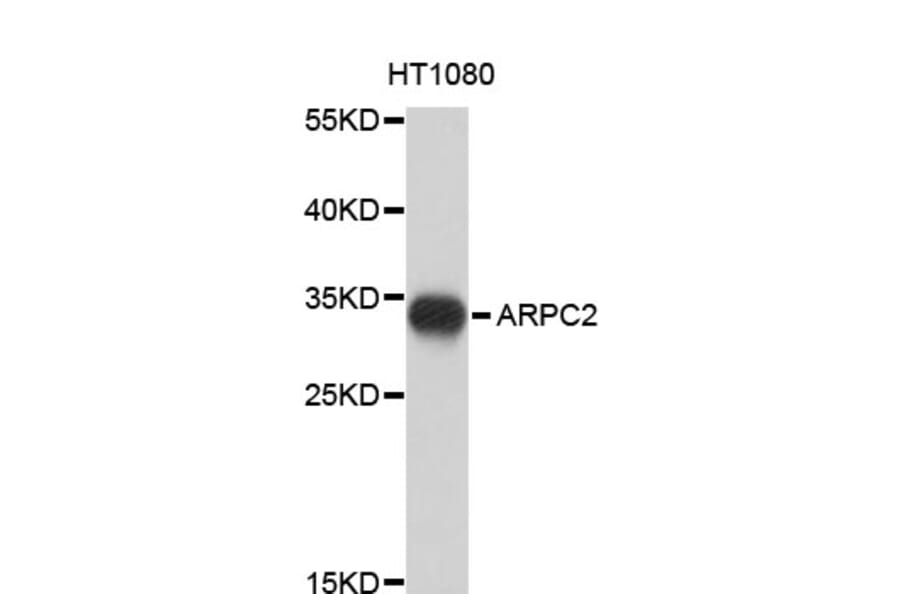 Western Blot - Anti-ARPC2 Antibody (A4375) - Antibodies.com