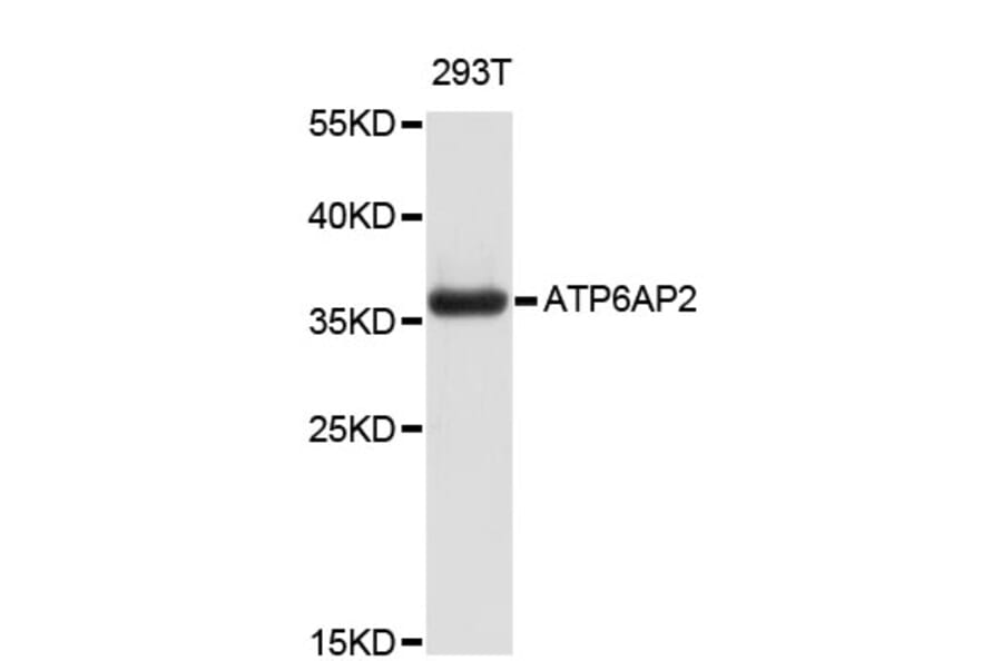 Western Blot - Anti-ATP6AP2 Antibody (A4380) - Antibodies.com