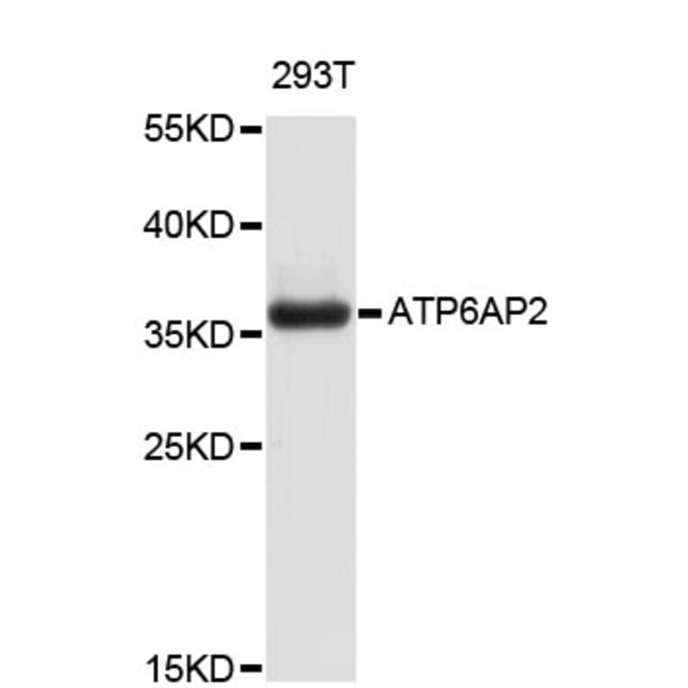 Western Blot - Anti-ATP6AP2 Antibody (A4380) - Antibodies.com