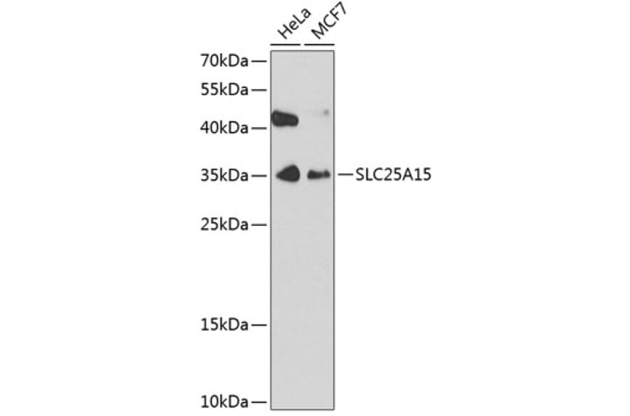 Western Blot - Anti-SLC25A15 Antibody (A4381) - Antibodies.com