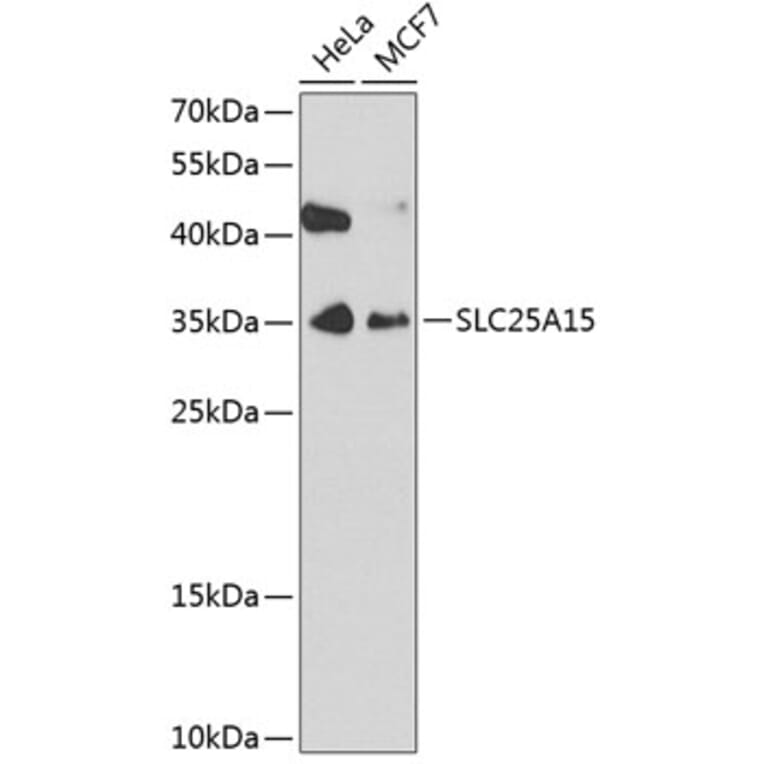Western Blot - Anti-SLC25A15 Antibody (A4381) - Antibodies.com