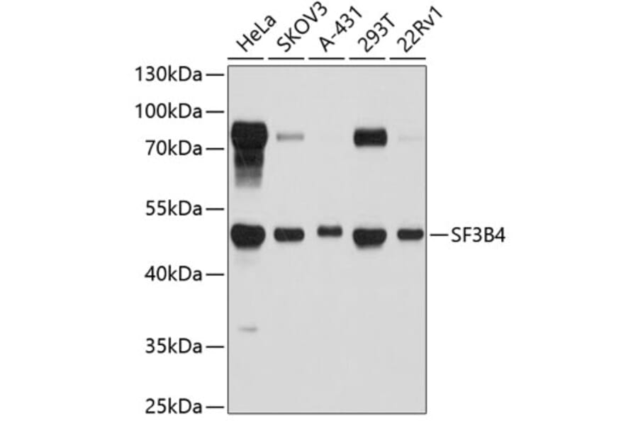 Western Blot - Anti-SF3B4 Antibody (A4394) - Antibodies.com