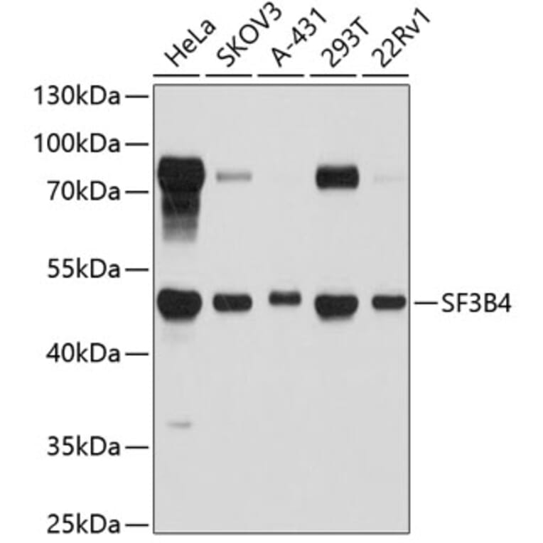 Western Blot - Anti-SF3B4 Antibody (A4394) - Antibodies.com