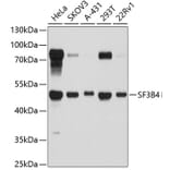 Western Blot - Anti-SF3B4 Antibody (A4394) - Antibodies.com