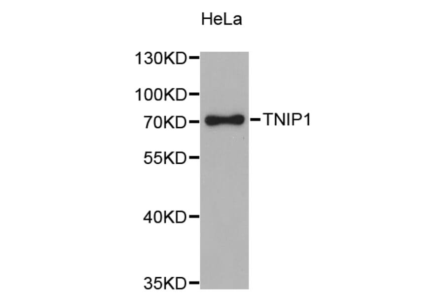 Western Blot - Anti-TNIP1 Antibody (A4404) - Antibodies.com
