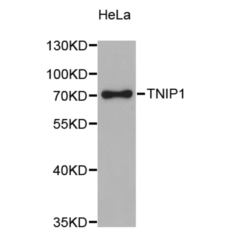 Western Blot - Anti-TNIP1 Antibody (A4404) - Antibodies.com
