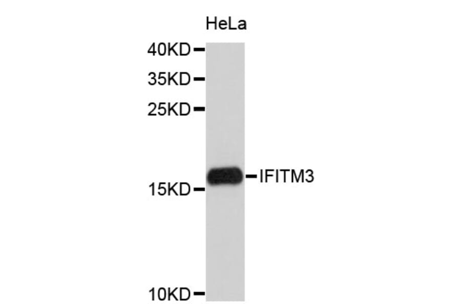 Western Blot - Anti-IFITM3 Antibody (A4415) - Antibodies.com
