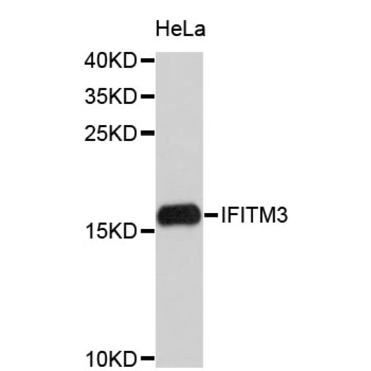 Western Blot - Anti-IFITM3 Antibody (A4415) - Antibodies.com