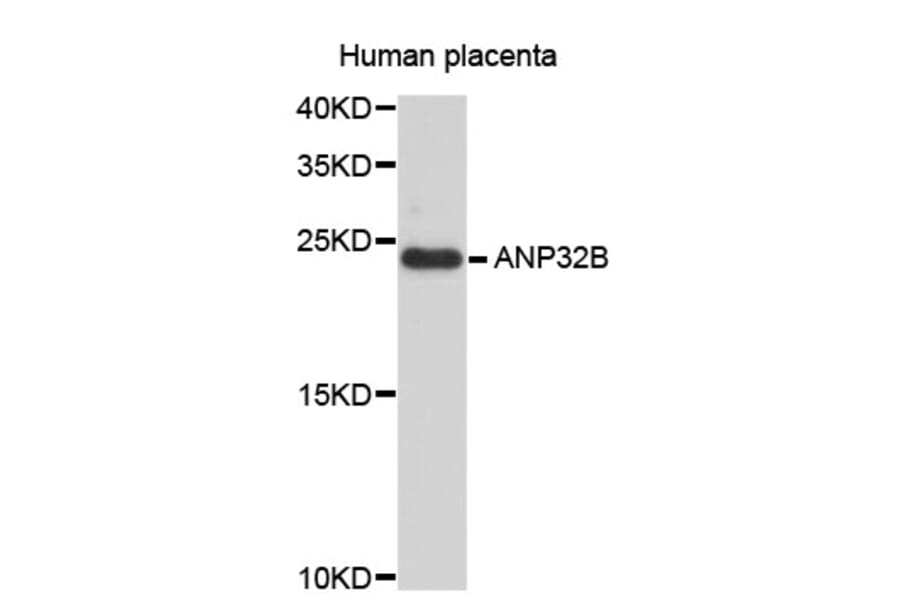 Western Blot - Anti-ANP32B Antibody (A4432) - Antibodies.com