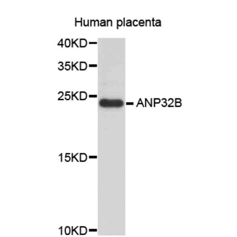 Western Blot - Anti-ANP32B Antibody (A4432) - Antibodies.com