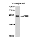 Western Blot - Anti-ANP32B Antibody (A4432) - Antibodies.com