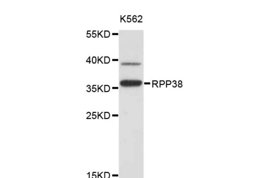 Western Blot - Anti-RPP38 Antibody (A4433) - Antibodies.com