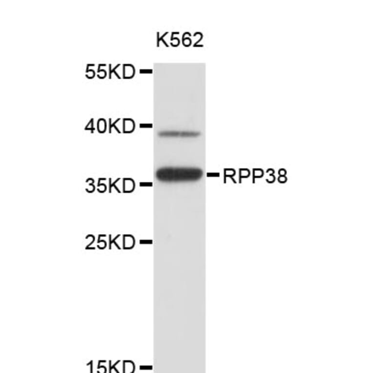 Western Blot - Anti-RPP38 Antibody (A4433) - Antibodies.com