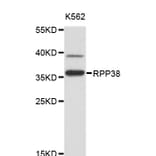 Western Blot - Anti-RPP38 Antibody (A4433) - Antibodies.com