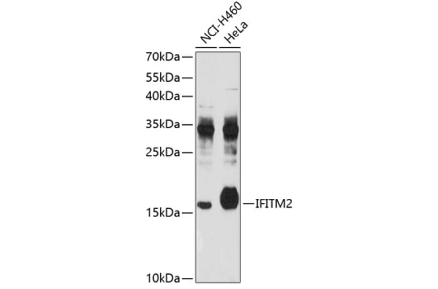Western Blot - Anti-IFITM2 Antibody (A4438) - Antibodies.com