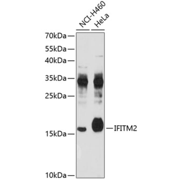 Western Blot - Anti-IFITM2 Antibody (A4438) - Antibodies.com