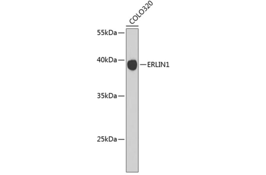 Western Blot - Anti-ERLIN1 Antibody (A4440) - Antibodies.com