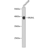 Western Blot - Anti-ERLIN1 Antibody (A4440) - Antibodies.com