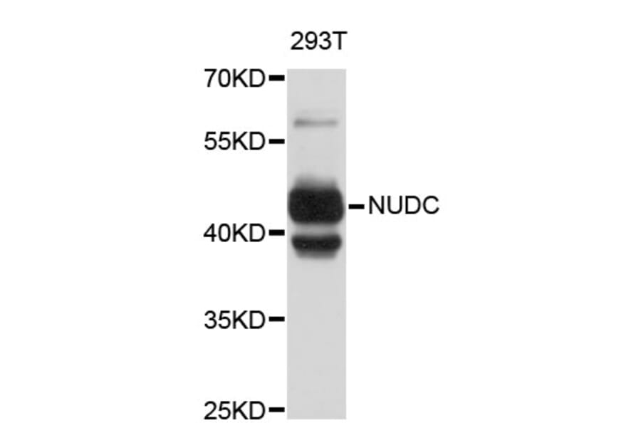 Western Blot - Anti-NUDC Antibody (A4450) - Antibodies.com