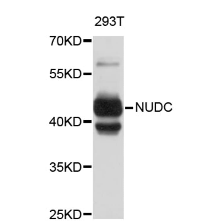 Western Blot - Anti-NUDC Antibody (A4450) - Antibodies.com
