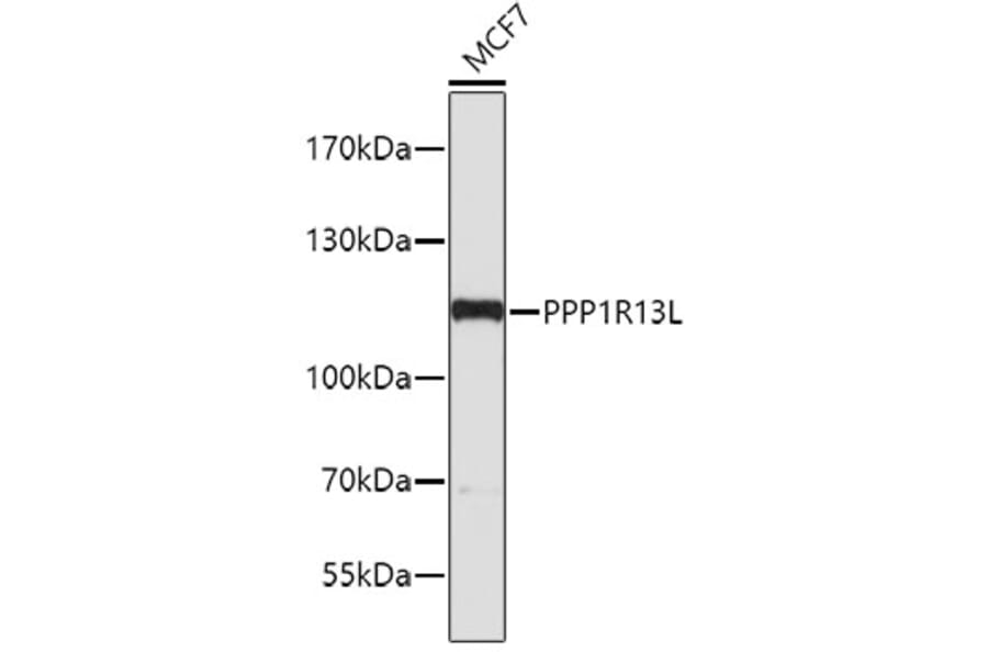 Western Blot - Anti-PPP1R13L Antibody (A4457) - Antibodies.com
