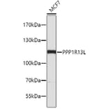 Western Blot - Anti-PPP1R13L Antibody (A4457) - Antibodies.com