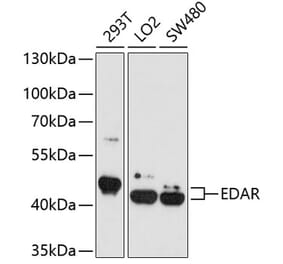 Western Blot - Anti-EDAR Antibody (A4461) - Antibodies.com