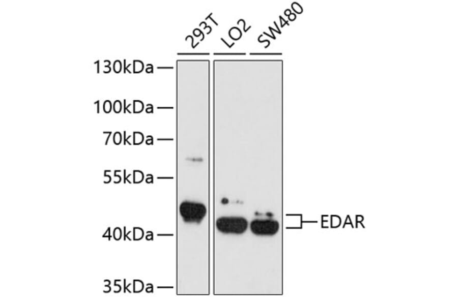 Western Blot - Anti-EDAR Antibody (A4461) - Antibodies.com