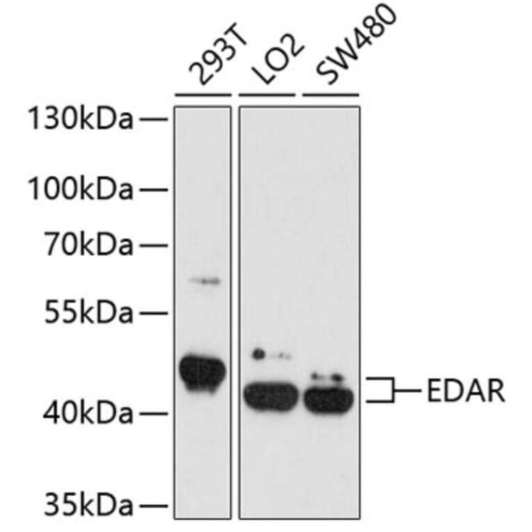 Western Blot - Anti-EDAR Antibody (A4461) - Antibodies.com