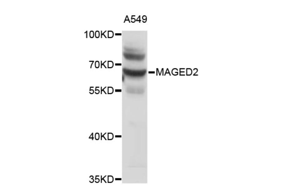 Western Blot - Anti-MAGED2 Antibody (A4462) - Antibodies.com