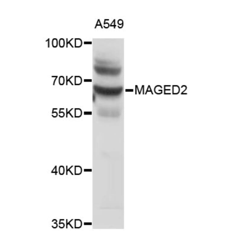 Western Blot - Anti-MAGED2 Antibody (A4462) - Antibodies.com