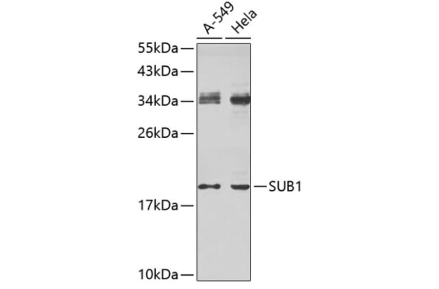 Western Blot - Anti-SUB1 Antibody (A4463) - Antibodies.com