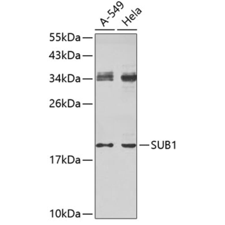 Western Blot - Anti-SUB1 Antibody (A4463) - Antibodies.com