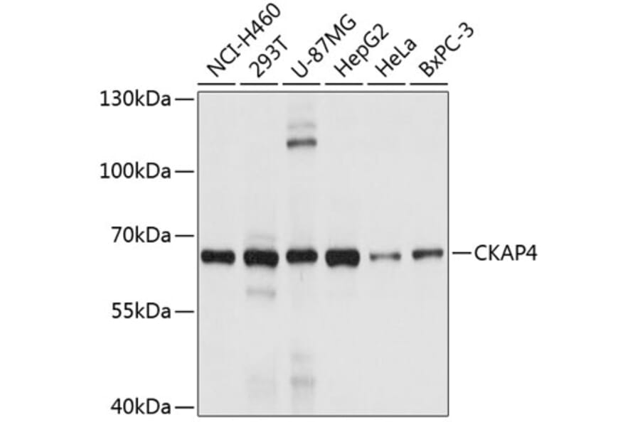 Western Blot - Anti-CKAP4 Antibody (A4468) - Antibodies.com